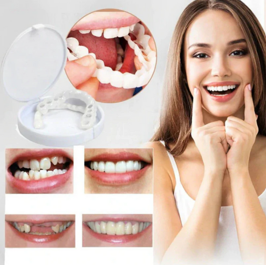 Snap-On Smile™: Carillas Dentales Ajustables - Dientes de Cerámica